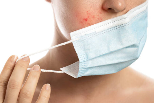 Red and oily skin with constant acne? Afraid of being troubled by the "mask muscle" problem!
