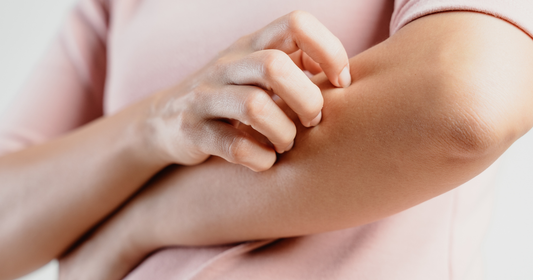 Eczema Keeps Coming Back: Can Probiotics Help? What Adults Should Know